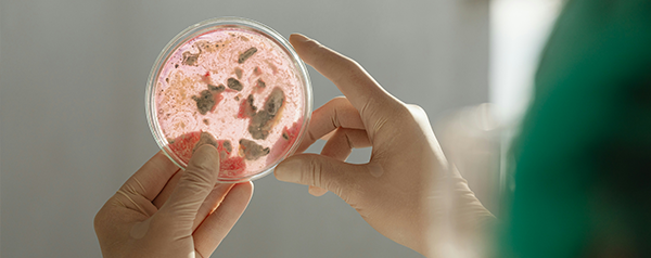 Mold Inspection & Mold Testing in Nashville, Franklin, Smyrna, Mt. Juliet, Brentwood, Murfreesboro, TN, and Surrounding Areas